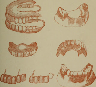 Vintage dentures (from Wikipedia)