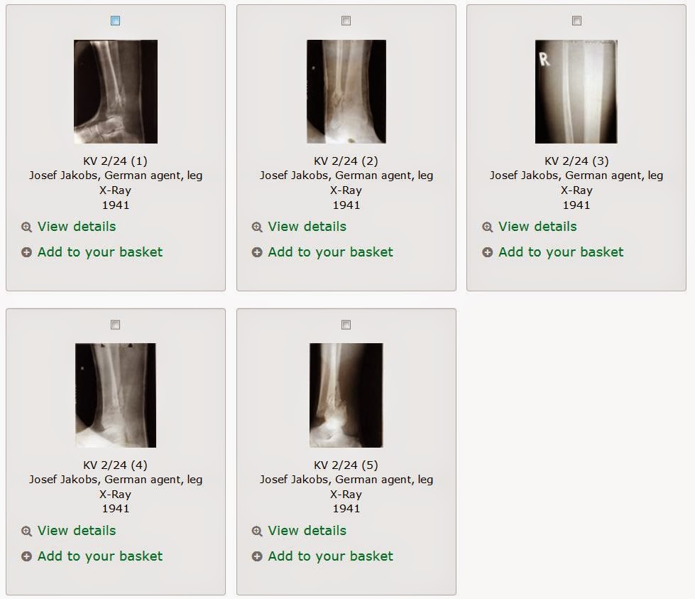 X-ray Images of Josef Jakobs' broken leg - Josef Jakobs - 1898-1941