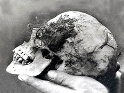 The skull found in the Wych Elm. (From Brian Haughton's website).